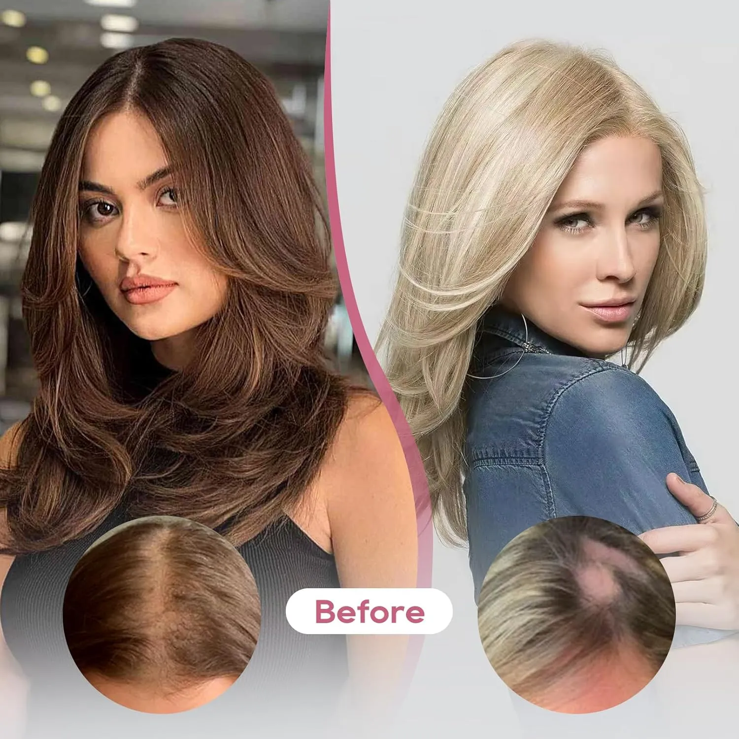 REECHO Real Human Hair Topper, 10 inch Women Hair Toppers for Thinning Hair, 100 Percent Human Hair Large Coverage Natural Hairpiece Wiglet, Standard Base 3.5"x2", Chestnut Brown with Highlights